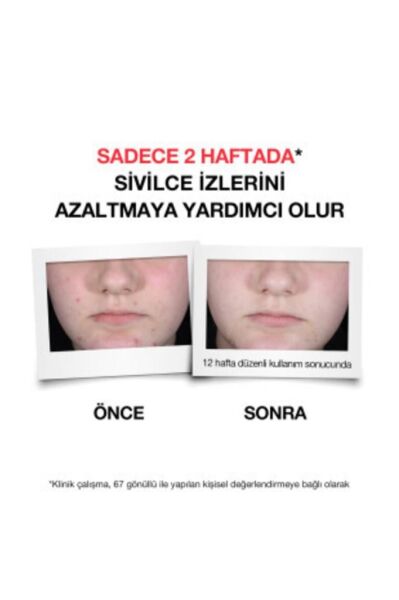 Neutrogena Düzensiz Cilt Tipleri için Yüz Yıkama Jeli 200 ml